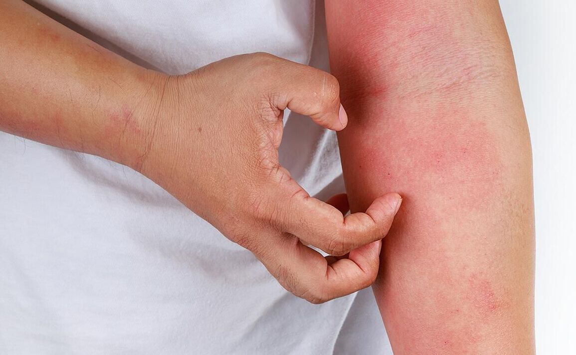 posibile complicații de la utilizarea sifonului