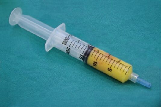 Seringa cu tesut adipos pentru lipofilling